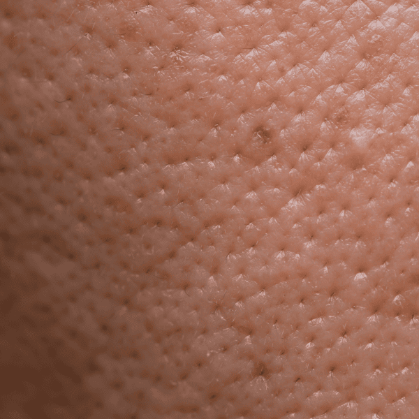 Pores