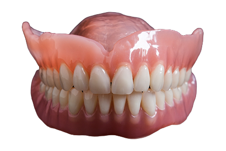 Missing Teeth – Dentures